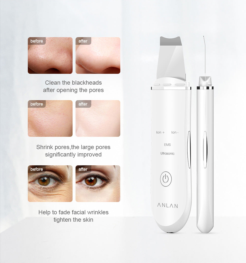 Ultrasonic Skin Scrubber Deep Face Cleaning
