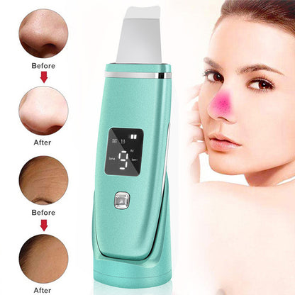 Ultrasonic vibration Deep Cleansing Blackhead Remover